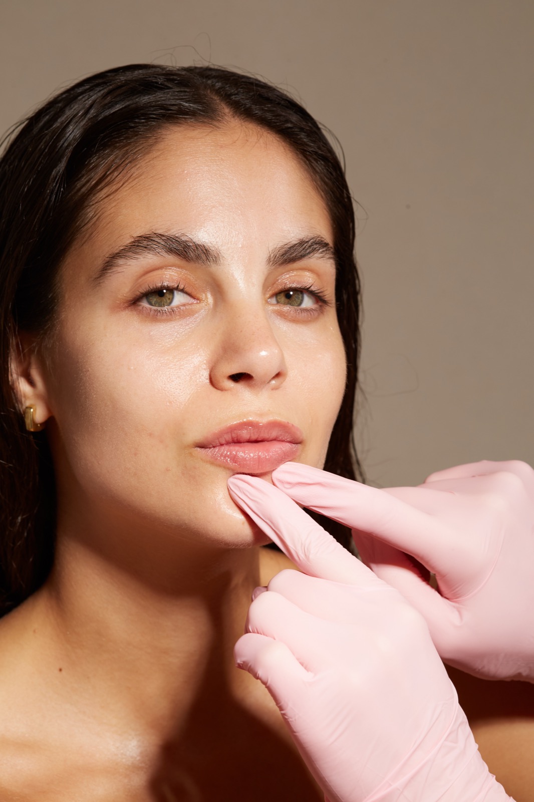 Aumento de labios